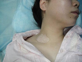 長(zhǎng)春博潤(rùn)皮膚病醫(yī)院