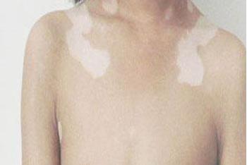 ӾLĲ