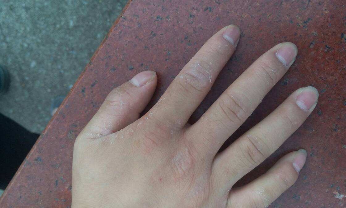 長春博潤皮膚病醫(yī)院